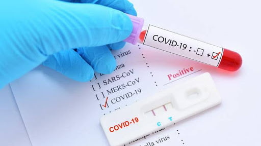 positif Covid-19