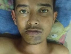 Jadi Korban Tabrak Lari di Jatinangor, Seorang Pria Tanpa Identitas Alami Hilang Ingatan
