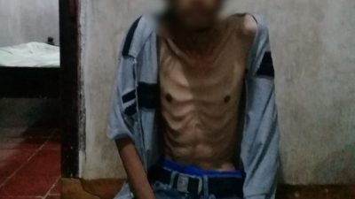 Sakit, Warga Cinangsi Cisitu Ini Butuh Bantuan