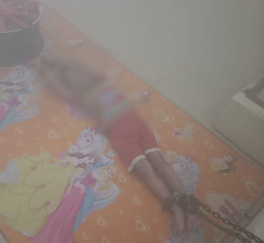 Anak 5 Tahun di Rantai Bibinya