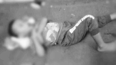 Kecelakaan Saat Bermain, Bocah 5 Tahun Harus Dilarikan ke RSUD