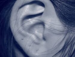 Cauliflower Ear: Penyebab, Gejala, dan Penanganannya