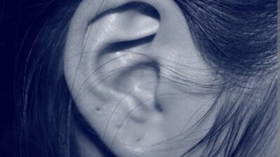 Cauliflower Ear Telinga