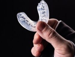 Mouth Guard: Manfaat, Jenis, dan Perawatannya untuk Pelindung Gigi Multifungsi