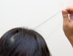 Trikotilomania: Gangguan Mencabut Rambut yang Perlu Diketahui