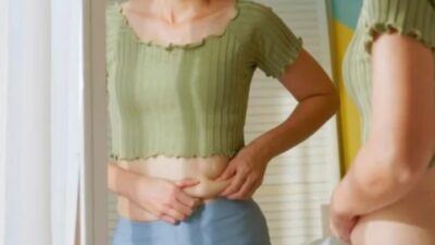 Body Dysmorphic Disorder
