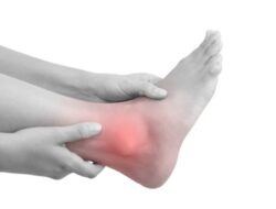Pentingnya Menjaga Kadar Asam Urat dalam Tubuh: Pencegahan dan Pengobatan