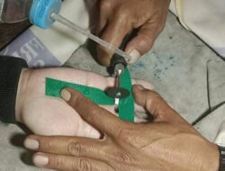 Jari Wanita Asal Cileunyi Bengkak Gegara Cincin Sulit Dilepas, Damkar Turun Tangan