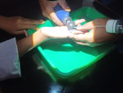 Cincin di Jari Tak Bisa Dilepas, Siswi Mts di Tanjungsari Sumedang Datangi Damkar