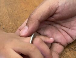 Ring Aluminium Nyangkut di Jari Manis Bayi 3 Tahun, Damkar Beri Bantuan
