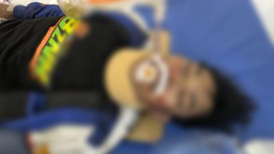 Pohon Tumbang di Jatinangor Timpa Pengguna Jalan, Satu Korban Kritis dan Dua Luka Berat